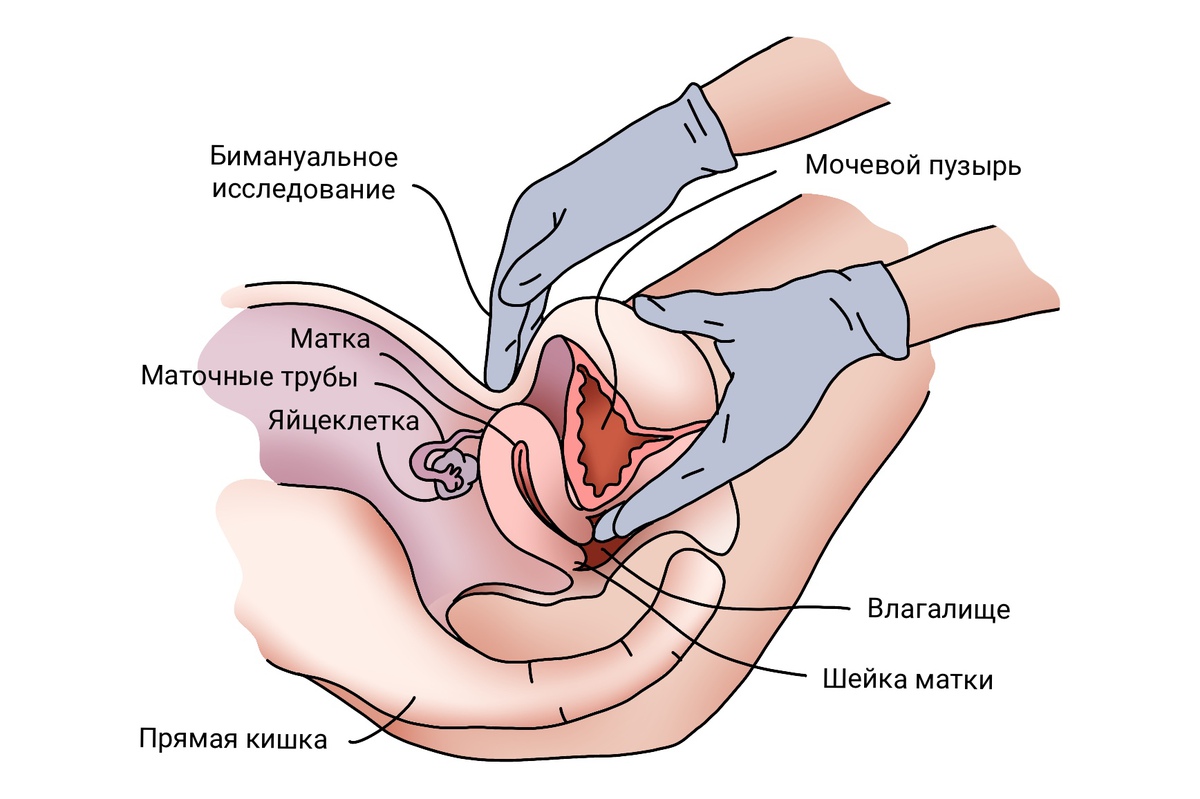 Двуручное исследование