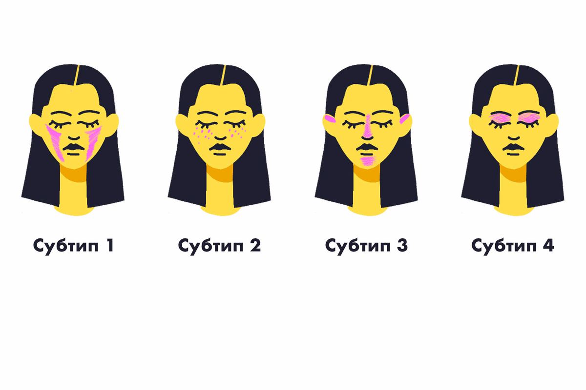 Розацеа типы