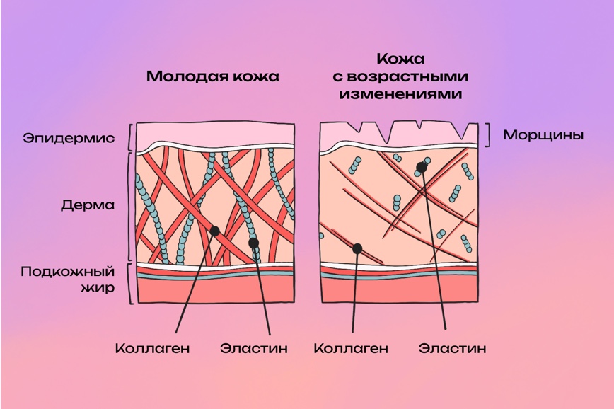 Со временем волокна коллагена в коже истончаются